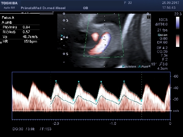 Doppler-Ultraschall-Bild